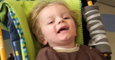 Menino de dois anos é curado de paralisia cerebral com células-tronco Menino de dois anos é curado de paralisia cerebral com células-tronco
